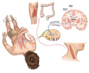 Terapia Bowen